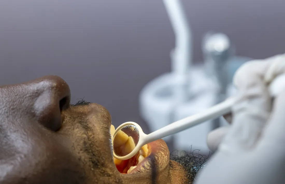 Doctor revisando la dentadura de un paciente con espejo dental