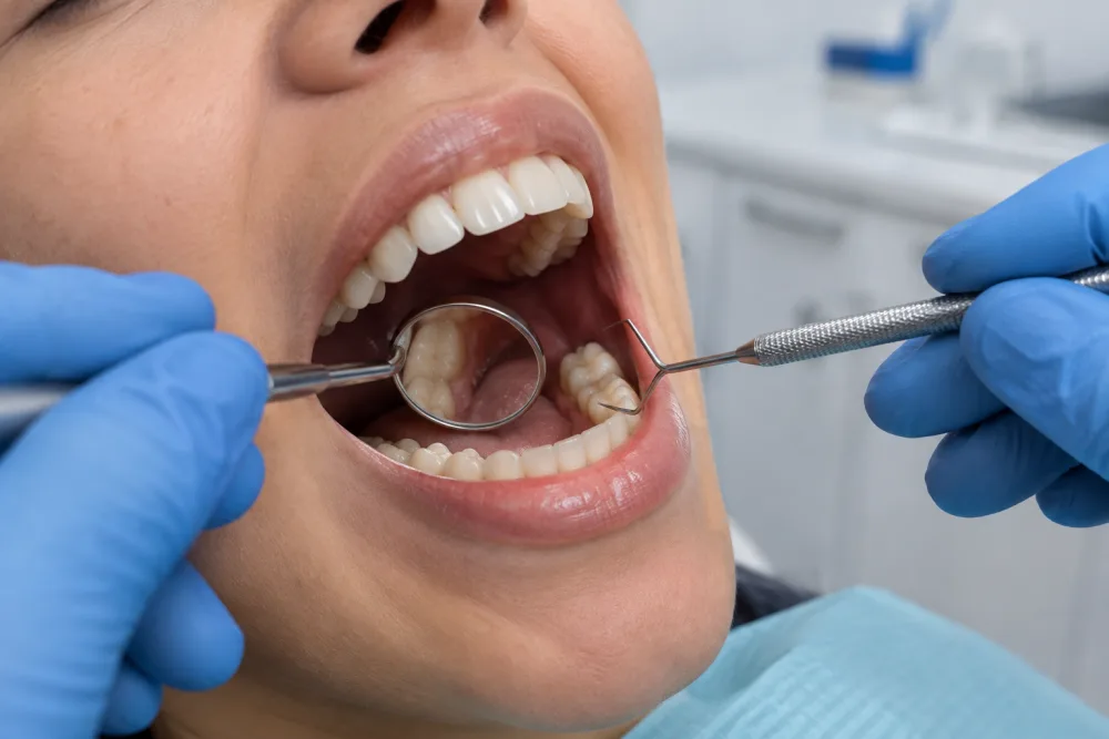 Revisión dental de cerca con espejo y explorador